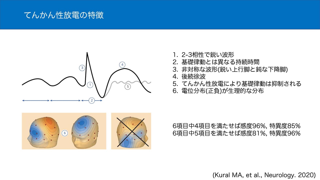 Medixpost | spikeの波形を定義する